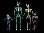 X Ray Family