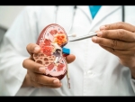 Get Advanced Treatment for Kidney Issues from the Best Kidney Doctor in Indore